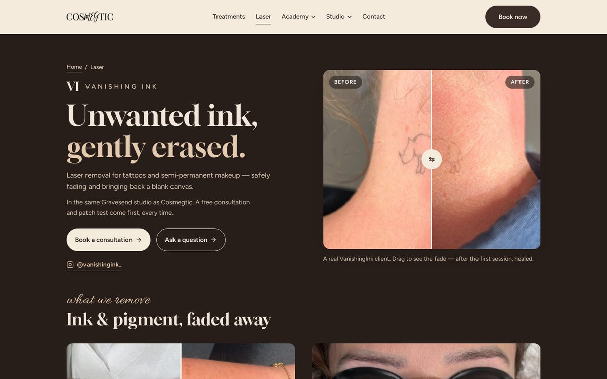 Vanishing Ink laser removal page